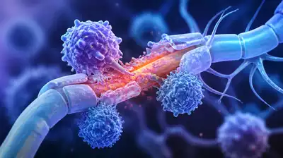 Nervenentzündungen im Kontext von Autoimmunerkrankungen